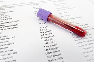 mid в анализе крови: расшифровка, нормальный уровень