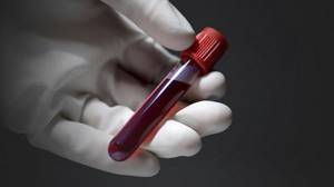 Подготовка к биохимическому анализу крови: что можно и нельзя делать