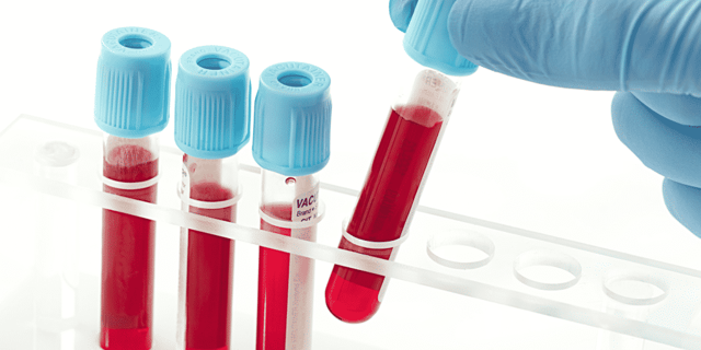 Анализ крови на гепатит: расшифровка, сколько делается, как сдать?