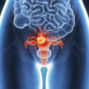 Биопсия шейки матки: как проводится, результаты, подготовка к процедуре