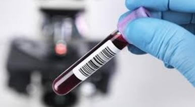 Ретикулоциты: обозначение в анализе крови, что это такое?