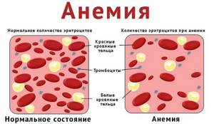 Гематокрит: что это такое в анализе крови, норма