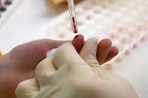 Чем отличается общий анализ крови от клинического?