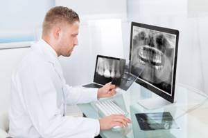 Компьютерная томография (КТ) челюсти – как делают?