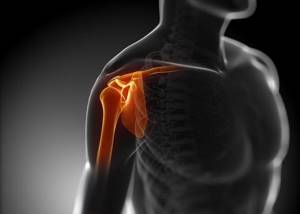 МРТ плечевого сустава: как делают и что можно обнаружить?