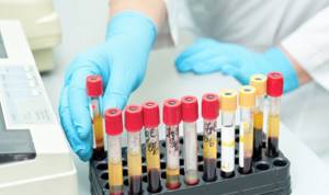 Обозначение ретикулоцитов в анализе крови