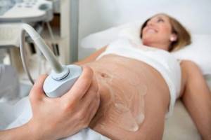 4Д-УЗИ при беременности: фото, что видно?