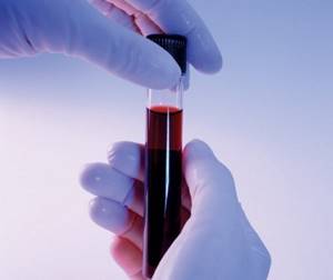 Что входит в общий анализ крови – какие анализы?