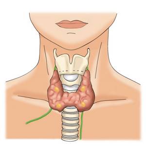 Расшифровка результатов УЗИ щитовидной железы
