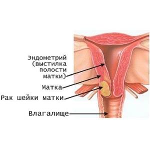 Норма размеров матки по УЗИ при беременности и после родов