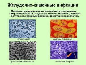 Определение наличия инфекции анализом кала на дизгруппу