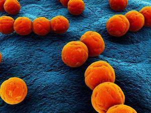 enterococcus faecalis в мазке у женщин и мужчин: о чем это говорит?