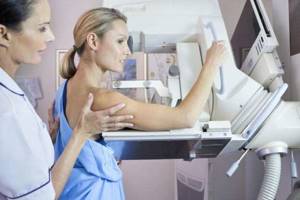 Когда делать маммографию: на какой день цикла лучше?