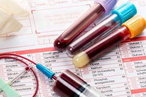 Клинический анализ крови – натощак или нет?