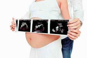 На каких сроках делают УЗИ при беременности?