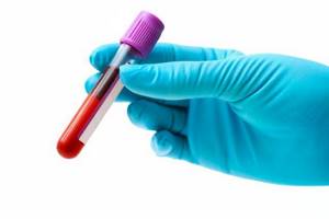 Анализ крови на иммуноглобулин Е: расшифровка, что покажет?