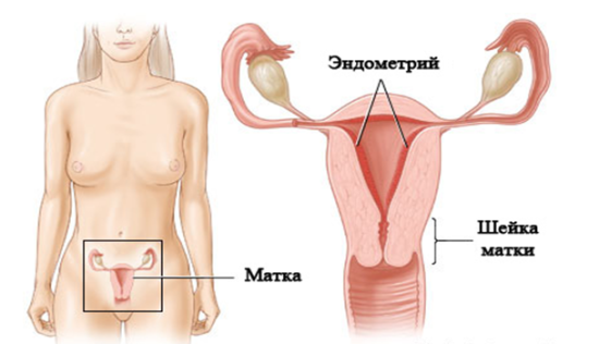 Биопсия эндометрия: как делают, что показывает?