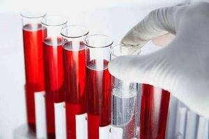 биохимический анализ крови: показатели, что в него входит?