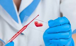 Анализ крови на стерильность – что показывает?