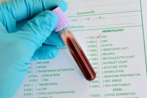 Развернутый анализ крови: расшифровка, нормы, что показывает?