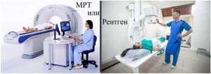 Рентген позвоночника: подготовка, что показывает, лучше ли чем МРТ?
