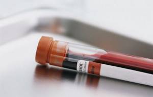 Расшифровка lym в анализе крови: нормы, что на нем видно?