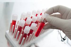 Анализ крови на антитела: виды, расшифровка