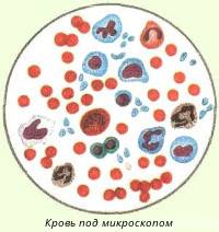 Объективные причины отклонения от нормы лейкоцитов в крови у мужчин