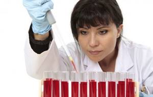 Гематологический анализ крови: расшифровка, нормальные показатели