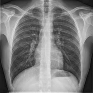 Рентген грудного отдела позвоночника – что показывает?