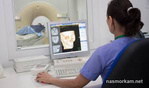 Компьютерная томография (КТ) околоносовых пазух и носа