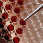 Повышены лейкоциты в крови при беременности: причины, последствия, лечение
