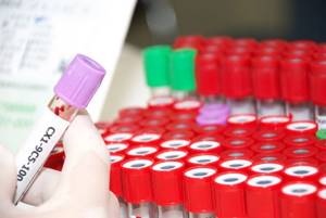 Билирубин в анализе крови: что это такое, нормы, расшифровка