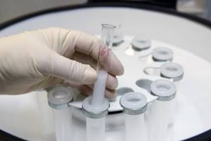 Посев спермы: показания к проведению анализа, результаты