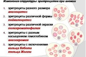 Норма эритроцитов в крови у женщин по возрасту (таблица)