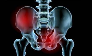 Рентген тазобедренного сустава: подготовка, нормы, как делают?