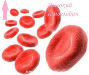 Повышенный гемоглобин в крови: причины, что это значит и что делать?