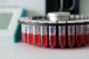 Расшифровка pct в анализе крови: нормы, что показывает?