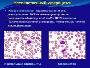 mchc в анализе крови: расшифровка, причины повышения, нормы