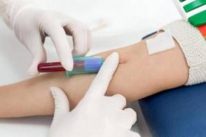Анализ крови на лямблии: расшифровка, как сдавать?